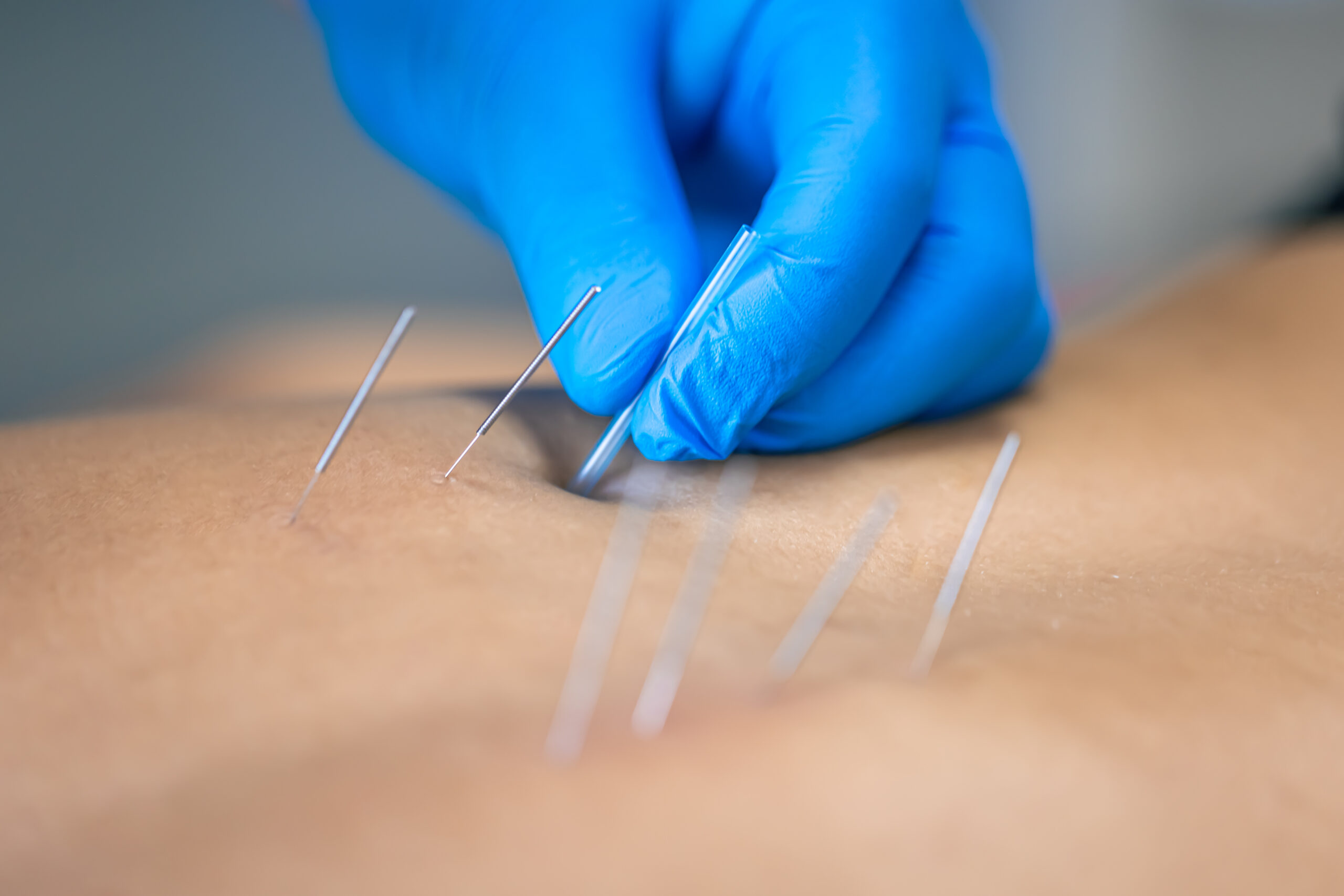Fellowship in Musculoskeletal Medicine